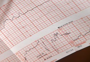 EKG-Papier mit Herzschlag